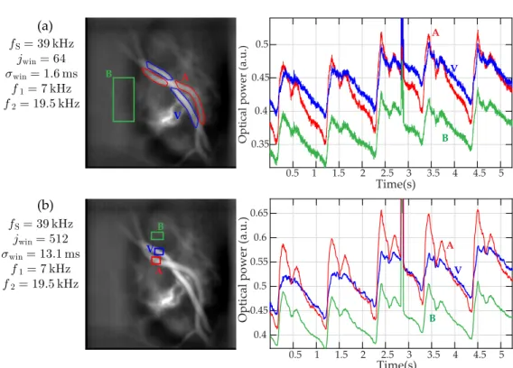 Fig. 6. Comparison of pulsatile flow measurements in a vein and an artery for two STFT analysis performed on the same dataset with (a) j win = 64 and (b) j win = 512 holograms.