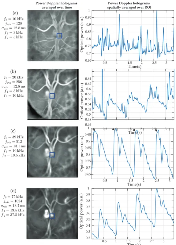 Fig. 9. Requirements in terms of sampling frequency for laser Doppler holography in the central retinal artery