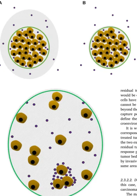 Fig. 1. Concentric tumor shrinkage as response to NACT. Gray-sha- Gray-sha-dowed surface: area of regression; green line: residual tumor bed;