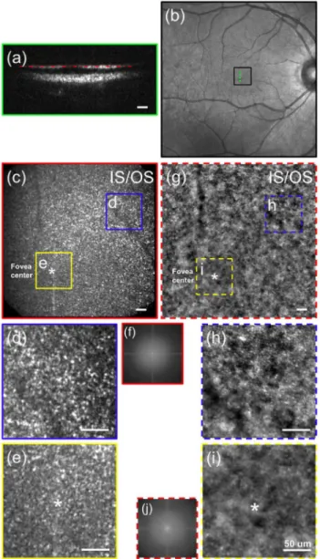 Fig. 3. In vivo human retinal imaging by (c) FFOCT compared with (g) AO retinal camera at the fovea