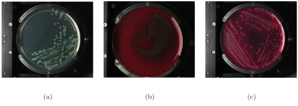 Figure 1.1: Example of Petri dish image with different illumination.