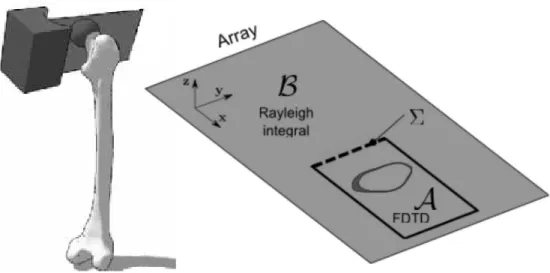 Figure 1: Representation of the configuration for the measurement of the wave field backscattered by the femoral neck cortical shell (left)