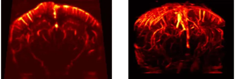 Fig. 1 Ultrasensitive Doppler imaging of the rat brain. Left: 2D ultrasensitive Doppler coronal plane