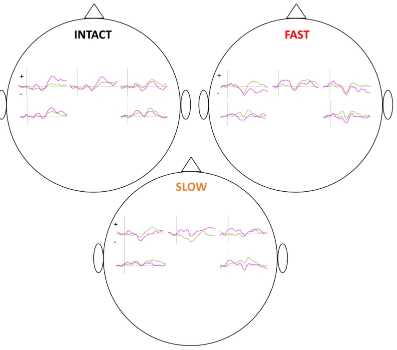 Fig. S2. Grand average of amplitude variations (on the y-axis in µV) of EEG responses over time (on the x-axis from – 200 to +800 ms) recorded at  F3, Fz, F4 (from left to right upper row, respectively), C3 and C4 (from left to right lower row, respectivel