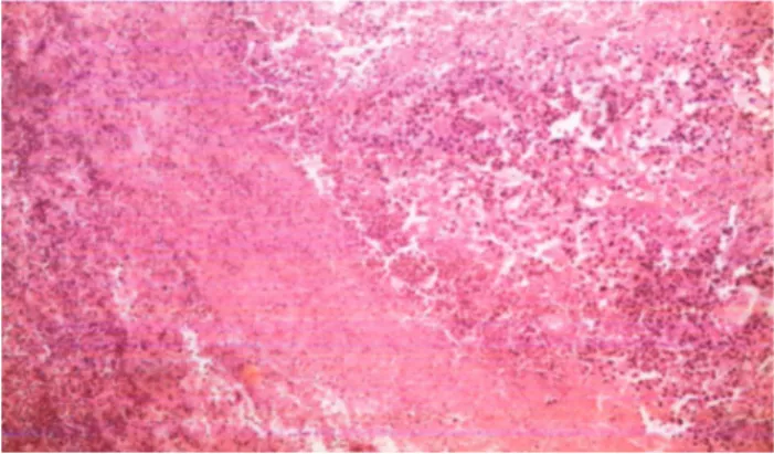 Figure 3.  Tumor sample from Treatment Group at day 37 (×10).