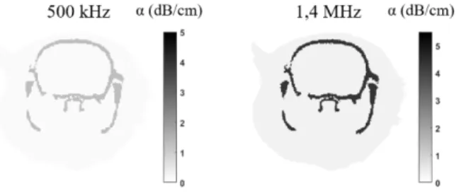 Figure 1. Coronal view of absorption maps at 500 kHz (left) and 1.4 MHz (right)