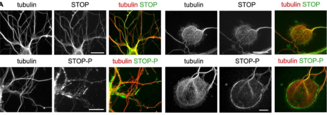 Figure 11 : Localisation de la protéine STOP phosphorylée dans des neurones d ☂ hippocampe différenciés  (d☂après Baratier et al, 2006)