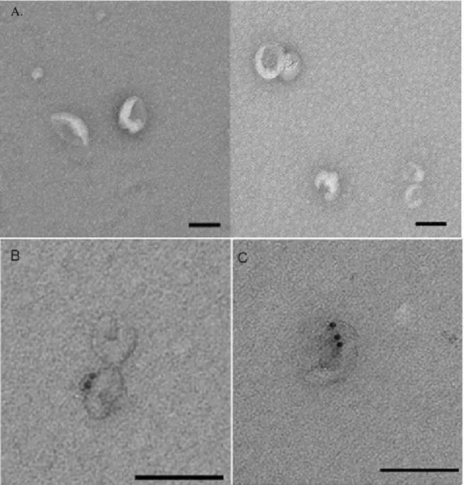 Figure 2: Exosomes are released by 15DIV primary cortical neurons.  