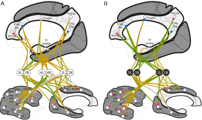 Figure 4. FDG results. Individual analysis of right (R) and left (L) hemispheres of the five patients (see Figure 3.B