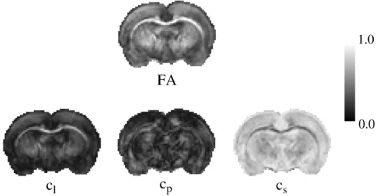 Figure 1.8 – Images des indices d’anisotropie. FA - Les pixels en hypersignal représentent une valeur de FA élevée