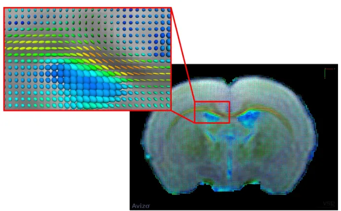 Figure 1.11 – Superposition des ellipsoïdes issues du DTI sur l’image de référence d’un cerveau de rat ex vivo hante resolution acquis à 7.0 T .