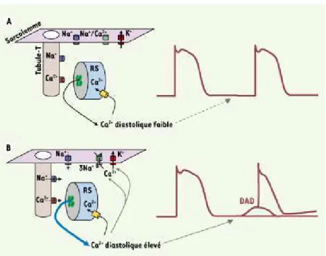 Figure 28. Mécanisme de survenue des DADs dans la TVPC (d’après (Lacampagne et al., 2008)