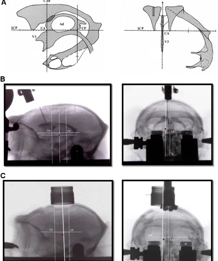 Figure 15 : Repérage ventriculographique. A : représentation schématique de la commissure  antérieure (CA) et postérieure (CP) (Percheron 1997); B : ventriculographie de primate, sur le  carde de stéréotaxique, avec repérage de la ligne CA-CP et de la loca