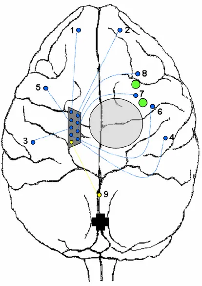 Figure 16 : Représentation schématique d’un cerveau de primate non humain avec les  différents éléments implantés lors de la chirurgie