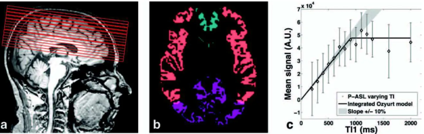 FIG. 2. a: Position of the multi-TI 1 imaging slices. The first slice of the PASL ROI is the same as the BoTuS slice