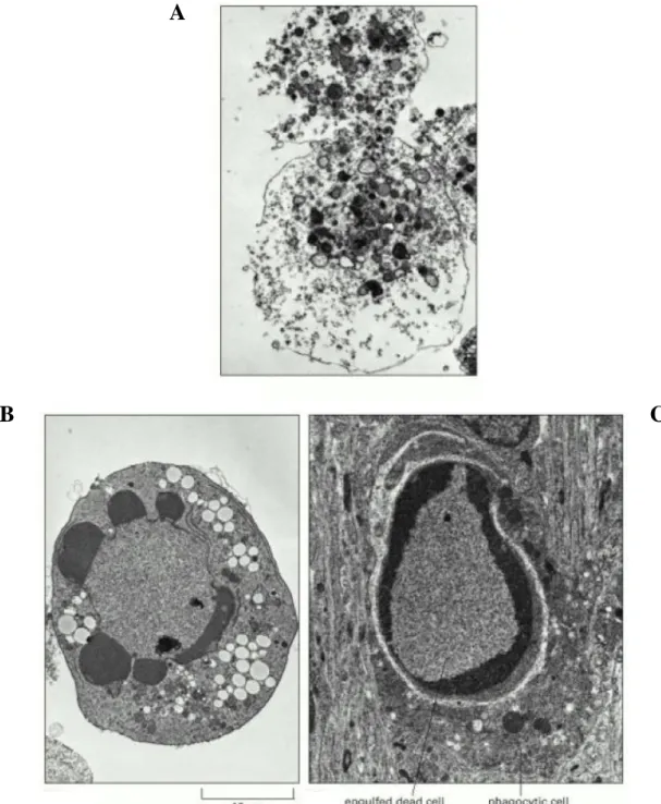 Figure 1 : Electronographies de cellules en train de mourir par nécrose (A) ou par apoptose (B et C)  prises au microscope électronique à transmission
