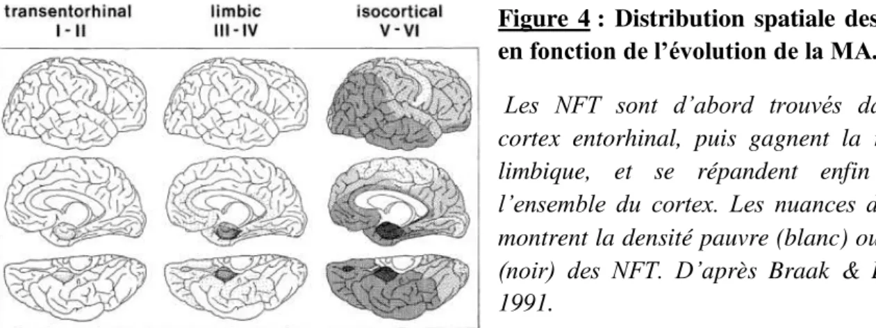Figure 4 : Distribution spatiale des NFT  en  fonction de l’évolution de la MA.