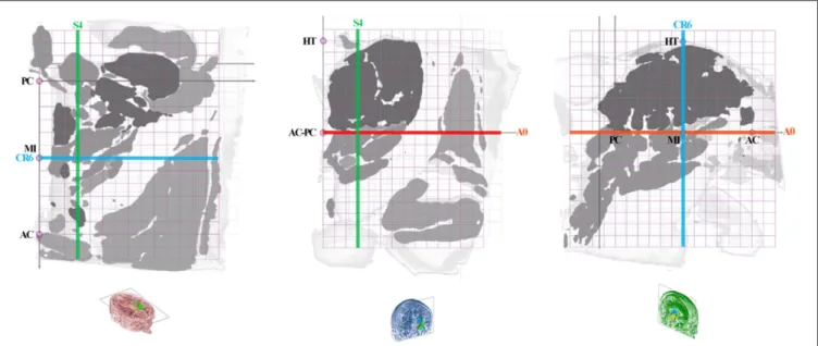 FIGURE 4 | Position of slices (colored lines: axial, red; coronal, blue; sagittal, green) on the axial ACPC plan (A0-ACPC; left row), coronal MI plan (CR6-MI;