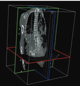 Figure 24 : Example of a 3D CT-scan images reconstruction (TurtelSeg) 