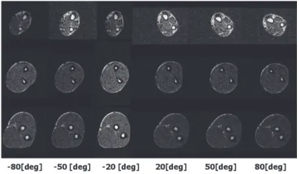 Figure 25: MRI imaging of the forearm during a pronosupination movement (Nojiri et al., 2008)  If X-ray, MRI or other expensive devices can be used to obtain a precise definition of the different  joints, some authors have proposed simpler and less costly 