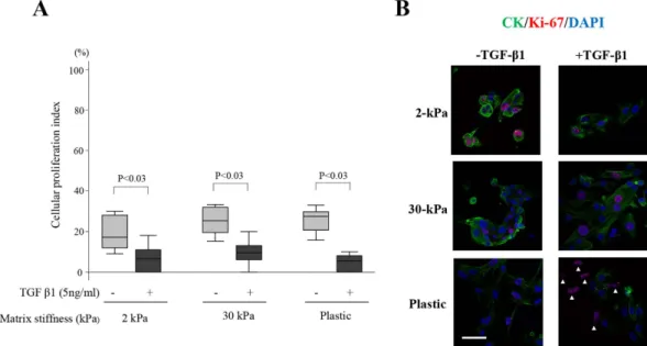 Figure 4.  Effects of increasing matrix stiffness with or without transforming growth factor (TGF-β1)  (5 ng/mL) stimulation on Ki-67 expression in endometrial epithelial cells of patients with endometriosis  (EEE)