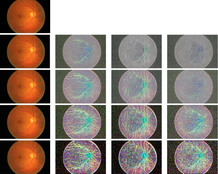 Figure 2. Wavelet decomposition on a healthy image from our database. Each row corresponds to a level of decomposition, the first column shows the approximation coefficient images, the second, third and fourth display respectively the horizontal, vertical 