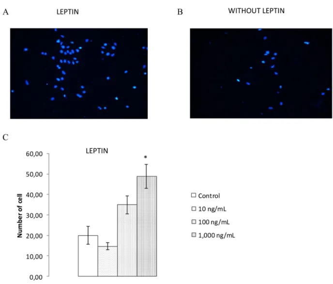Figure 7. Effect of leptin on invasion of MCF7 cells. Invasion of MCF7 with (A) or without (B) leptin treatment (1,000 ng/mL)