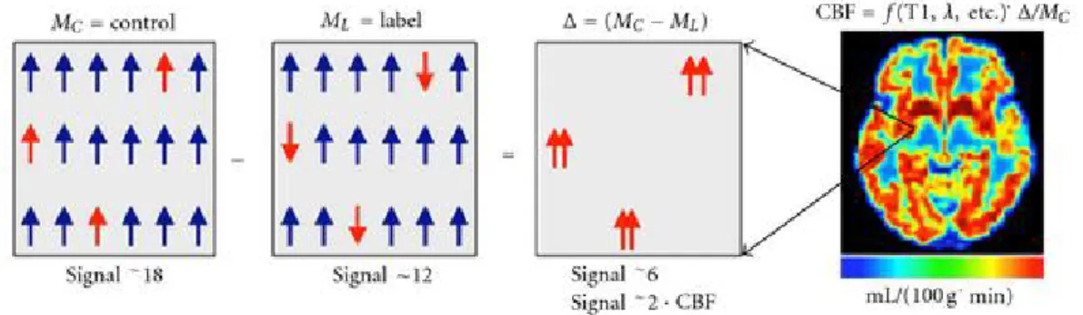 Figure 1.9.: Arterial spin labeling principle. The three first panels represent the signal from a single voxel that originates from a control condition (left), a label condition (middle) and the resulting control-label difference (right): after subtraction