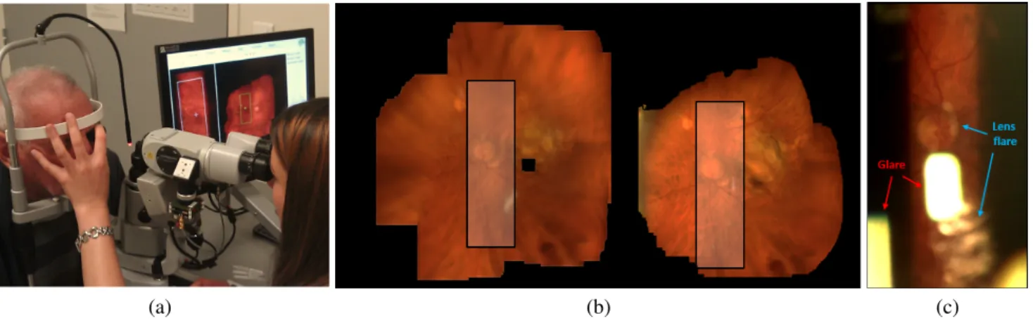 Figure 1: Retinal image mosaicing with a slit-lamp. (a) a slit-lamp NPRP system, developed at QuantelMedical, France and (b) sample mosaics constructed during an examination session with the slit-lamp, the FOV is shown as a rectangular region and (c) - a t