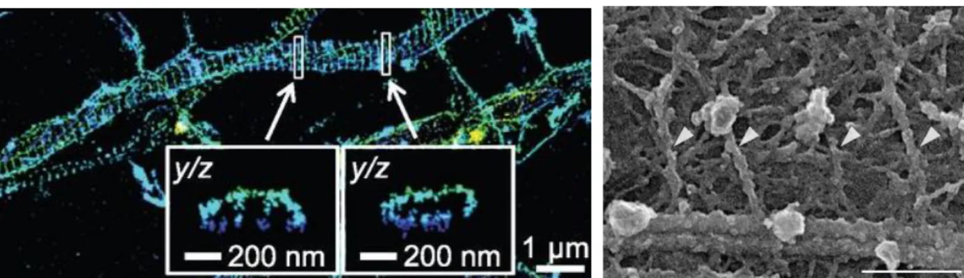Figure 23: actin forms rings within the axon. Actin rings in the axon shaft observed with STORM (left from Xu et al., 2013) or  with cryo electron microscopy (right, from Vassilopoulos et al., 2019) 