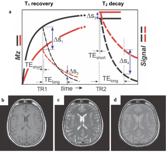 Figure  11:  Relaxation  times  introduce  endogenous  contrast  between  tissue  types