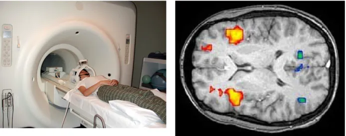 Fig. 6 – Un scanner IRM (à gauche) et une image (à droite) (source : University of Florida).