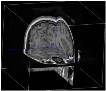 Fig. 1.2 – Un modèle de tête pour la FDM (source : University of South Carolina).