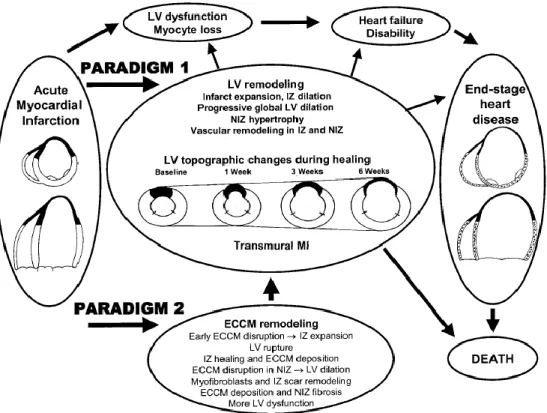 Figure 5. Two paradigms relating to LV remodeling. Top, cascade from acute transmural  MI to heart failure and death