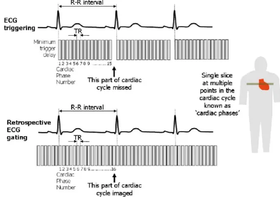 Figure 8.  Two ECG gating techniques used in cardiac MRI.  Ref.  (67) 