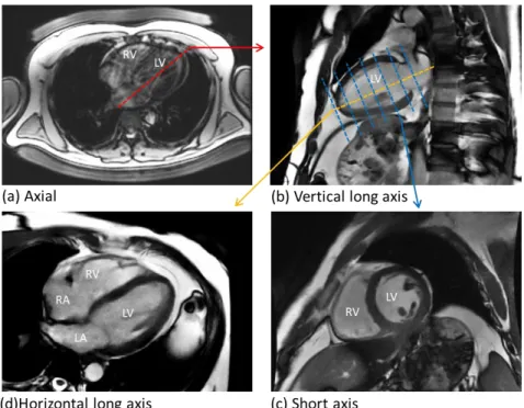 Figure 9. Sequential imaging planes for cardiac MRI. 