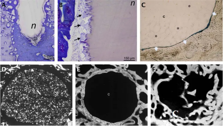 FIGURE 4. Osseointegration and biodegradation of nacre in sheep. A: Histological aspect of nacre screw after a 2-month implantation period in the first metatarsus