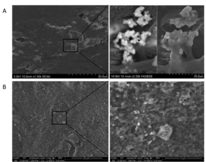 Fig. 3. Characterization of nodules by Raman spectroscopy. OA osteoblasts and MC3T3-E1 were treated for 21 days with ESM (200 l g/ml) to induce mineralization, fixed, dehydrated