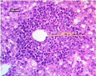 Figure  1.  Liver  histopathology  showing  the  different  values  of  the  lesion  score  used  to  evaluate  hepatocellular degeneration