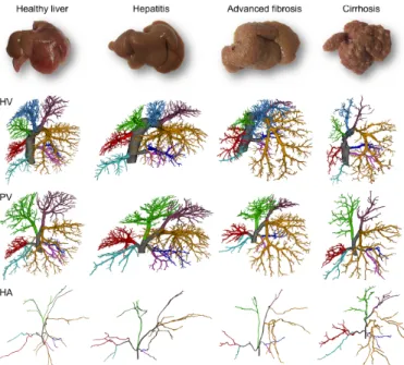 Fig  1.  Lobar  branching  schemes  of  each  vascular  tree  (HV,  PV,  and  HA)  at  different  time  points  during  cirrhogenesis
