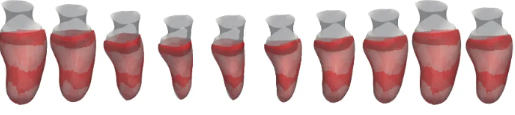 Fig. 3. Overlap of the segmented mesh and the deformed generic mesh over one cardiac cycle