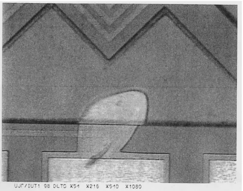 Figure 39 : Image au microscope optique d'un défaut de lithographie au niveau de la métallisation.