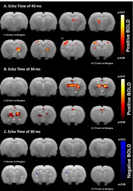 Fig 4. BOLD responses to unilateral sensorimotor electrical hindpaw stimulation. Statistical maps calculated from group analysis (n = 12; 0.05p-value0.01) are overlaid onto a template rat brain (eight axial slices centered at -3.24 mm to Bregma to +0.72 mm