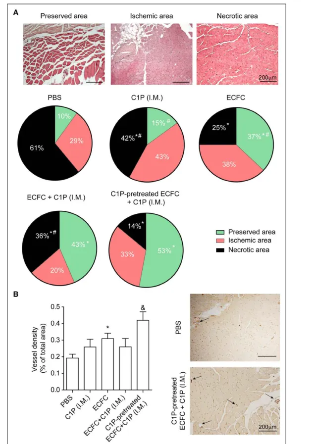 Figure 6. Administration of ceramide 1-phosphate (C1P)–pretreated endothelial colony–forming cell (ECFC) together with local  C1P reduces necrosis and increased vascular density in the ischemic muscle