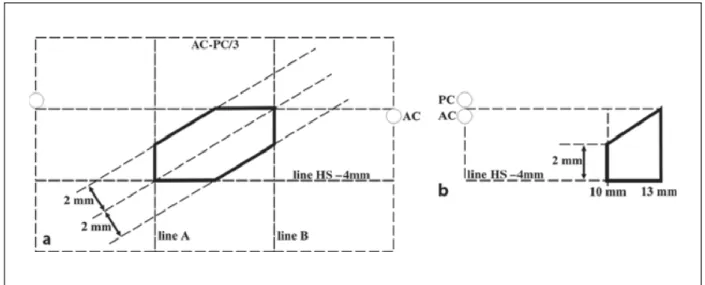 Figure 3. Talairach’s stereotactic diagram. a Lateral. b Front. 