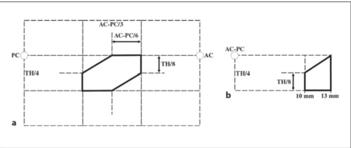 Figure 4. Benabid’s stereotactic diagram. a Lateral. b Front. 
