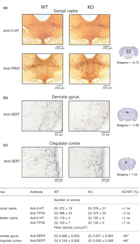 Table 4 5-HT soma number and terminal density in brain areas of WT and STOP KO mice