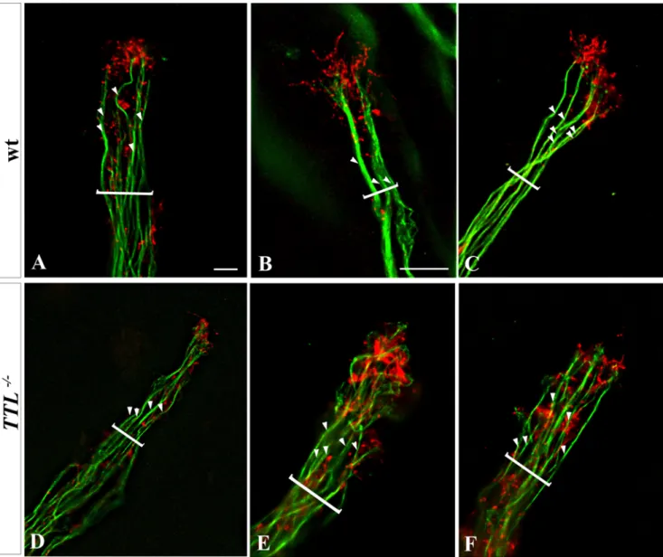 Figure 7. Impaired Actin-MT cytoskeleton relative organization in growth cones of TTL 2/2 neurons