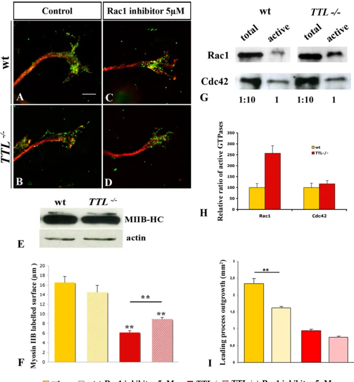 Figure 8. Impaired Myosin IIB recruitment at the growth cone of TTL 2/2 neurons. (A–D) Growth cones from E12.5 PCN neurons in collagen assays after 2 DIV