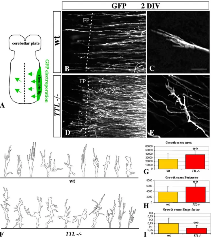 Figure 2. The morphology of the growth cone is impaired at the vicinity of the floor plate in TTL 2/2 embryos